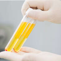 ACP – Autologous Conditioned Plasma